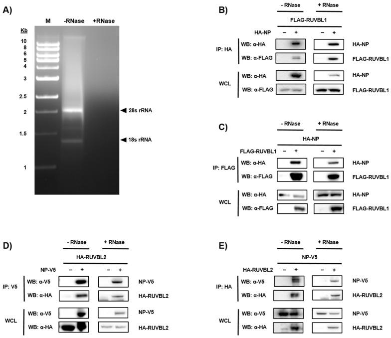 https://cdn.ncbi.nlm.nih.gov/pmc/blobs/824e/6521077/80b1dbf3e6a9/viruses-11-00372-g002.jpg