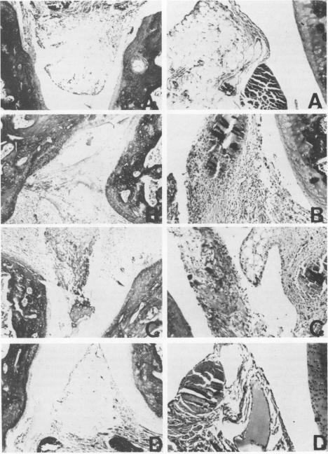 https://cdn.ncbi.nlm.nih.gov/pmc/blobs/8256/258422/f397cd704a30/iai00049-0163-a.jpg