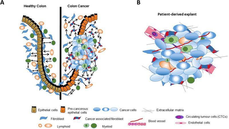 https://cdn.ncbi.nlm.nih.gov/pmc/blobs/8256/7868082/a2a11795e83c/CTM2-11-e308-g001.jpg
