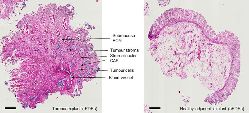 https://cdn.ncbi.nlm.nih.gov/pmc/blobs/8256/7868082/bcec64c4ad8e/CTM2-11-e308-g002.jpg