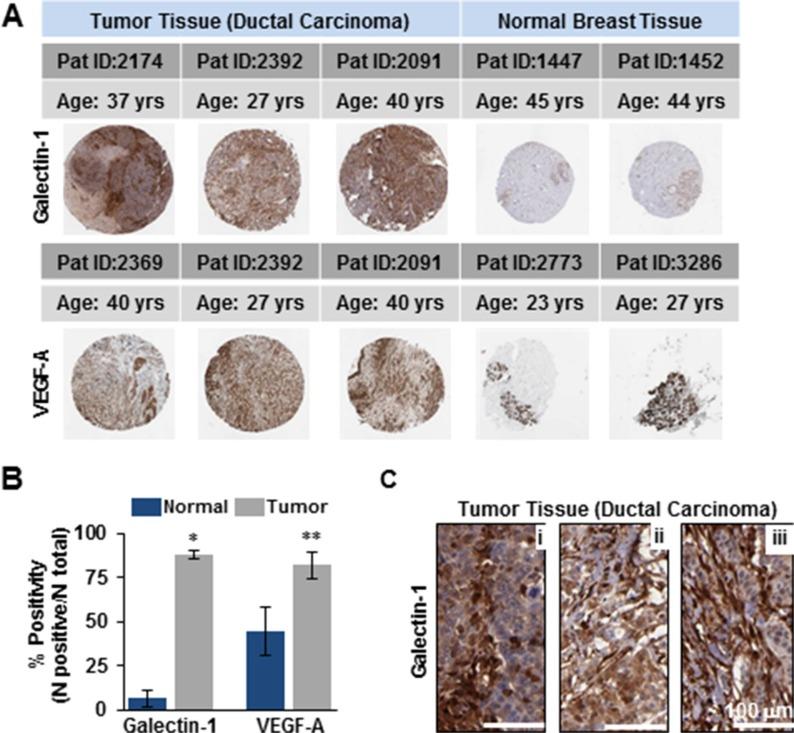 https://cdn.ncbi.nlm.nih.gov/pmc/blobs/825f/5173078/1e3a134dd609/oncotarget-07-41559-g001.jpg