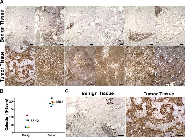 https://cdn.ncbi.nlm.nih.gov/pmc/blobs/825f/5173078/e01332327a3a/oncotarget-07-41559-g003.jpg