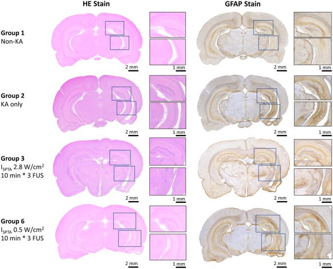 https://cdn.ncbi.nlm.nih.gov/pmc/blobs/826c/9587190/b6c5a7455315/13311_2022_1250_Fig7_HTML.jpg