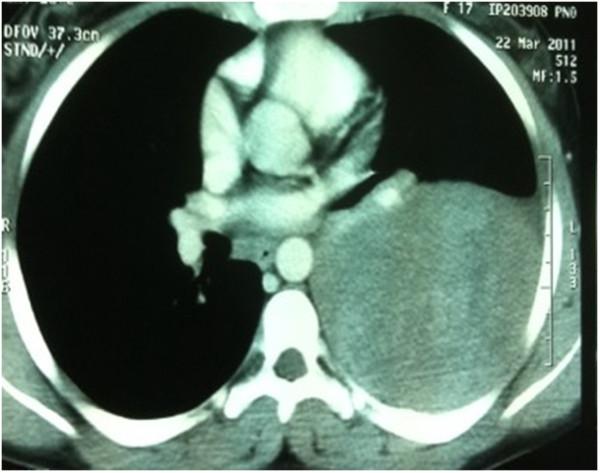 https://cdn.ncbi.nlm.nih.gov/pmc/blobs/8273/3556149/ca4106fb1b70/1477-7819-11-10-1.jpg