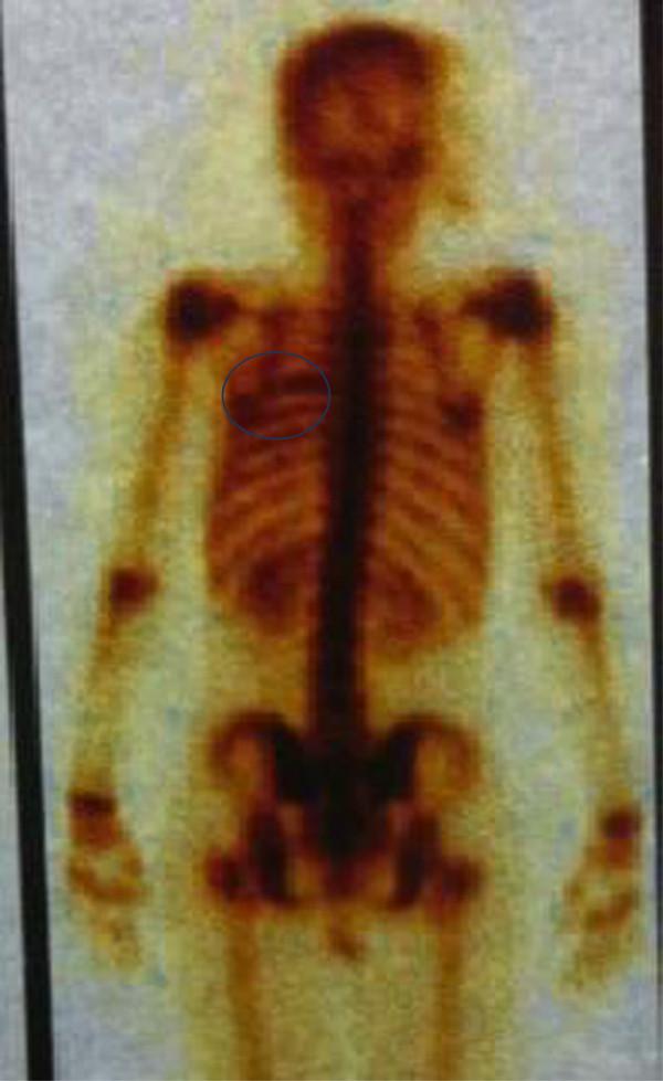 https://cdn.ncbi.nlm.nih.gov/pmc/blobs/8273/3556149/d4c73e07a0d8/1477-7819-11-10-2.jpg