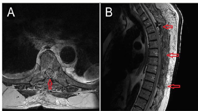 https://cdn.ncbi.nlm.nih.gov/pmc/blobs/8274/9212898/d2f63f976475/cureus-0014-00000025212-i02.jpg