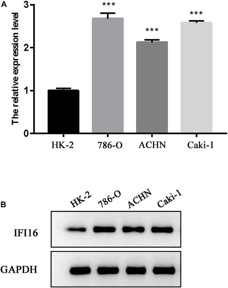 https://cdn.ncbi.nlm.nih.gov/pmc/blobs/8275/7917296/53650012917f/fgene-12-599952-g003.jpg