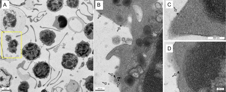 https://cdn.ncbi.nlm.nih.gov/pmc/blobs/8276/7893534/10c075e8c9c9/ntnov05p0240g004.jpg