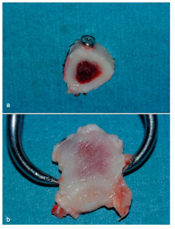 https://cdn.ncbi.nlm.nih.gov/pmc/blobs/8276/8123155/6f87c218b936/materials-14-02185-g005.jpg