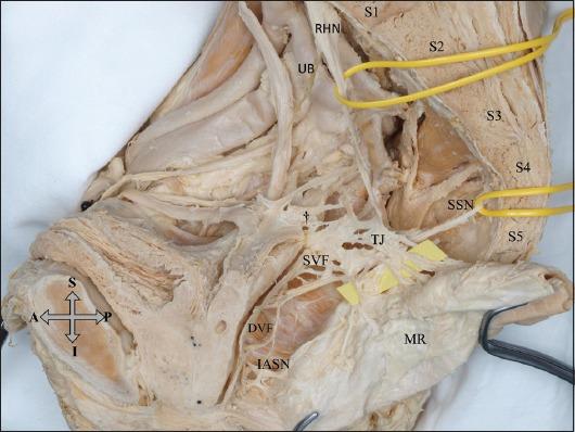https://cdn.ncbi.nlm.nih.gov/pmc/blobs/8278/6686088/20aabc4c1ac9/AnnGastroenterol-32-431-g004.jpg
