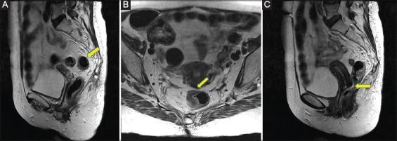 https://cdn.ncbi.nlm.nih.gov/pmc/blobs/8278/6686088/f88be6da6b3c/AnnGastroenterol-32-431-g001.jpg