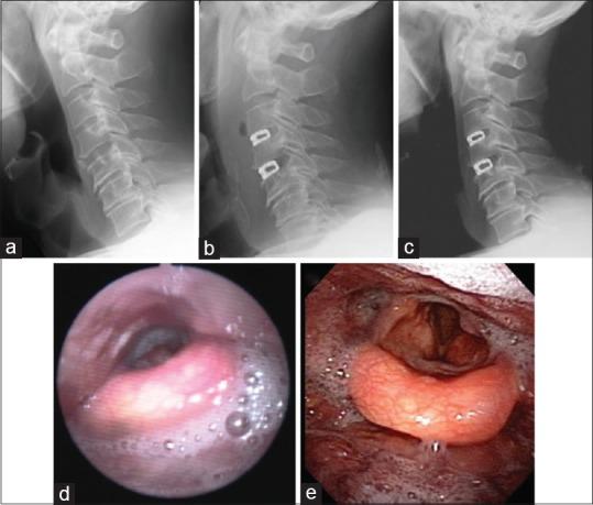 https://cdn.ncbi.nlm.nih.gov/pmc/blobs/827b/5634103/386c1d564969/JCVJS-8-179-g010.jpg