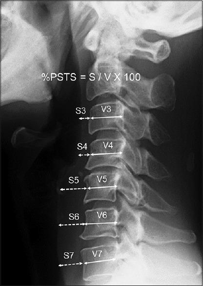 https://cdn.ncbi.nlm.nih.gov/pmc/blobs/827b/5634103/5b0975e80458/JCVJS-8-179-g003.jpg