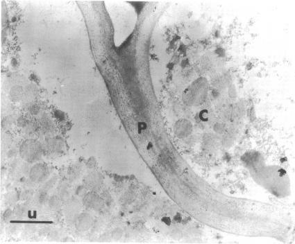 https://cdn.ncbi.nlm.nih.gov/pmc/blobs/827d/187058/99aa1ec30abd/applmicro00023-0152-a.jpg