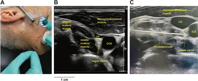 https://cdn.ncbi.nlm.nih.gov/pmc/blobs/827f/11455679/664d005ee554/10741_2024_10430_Fig3_HTML.jpg