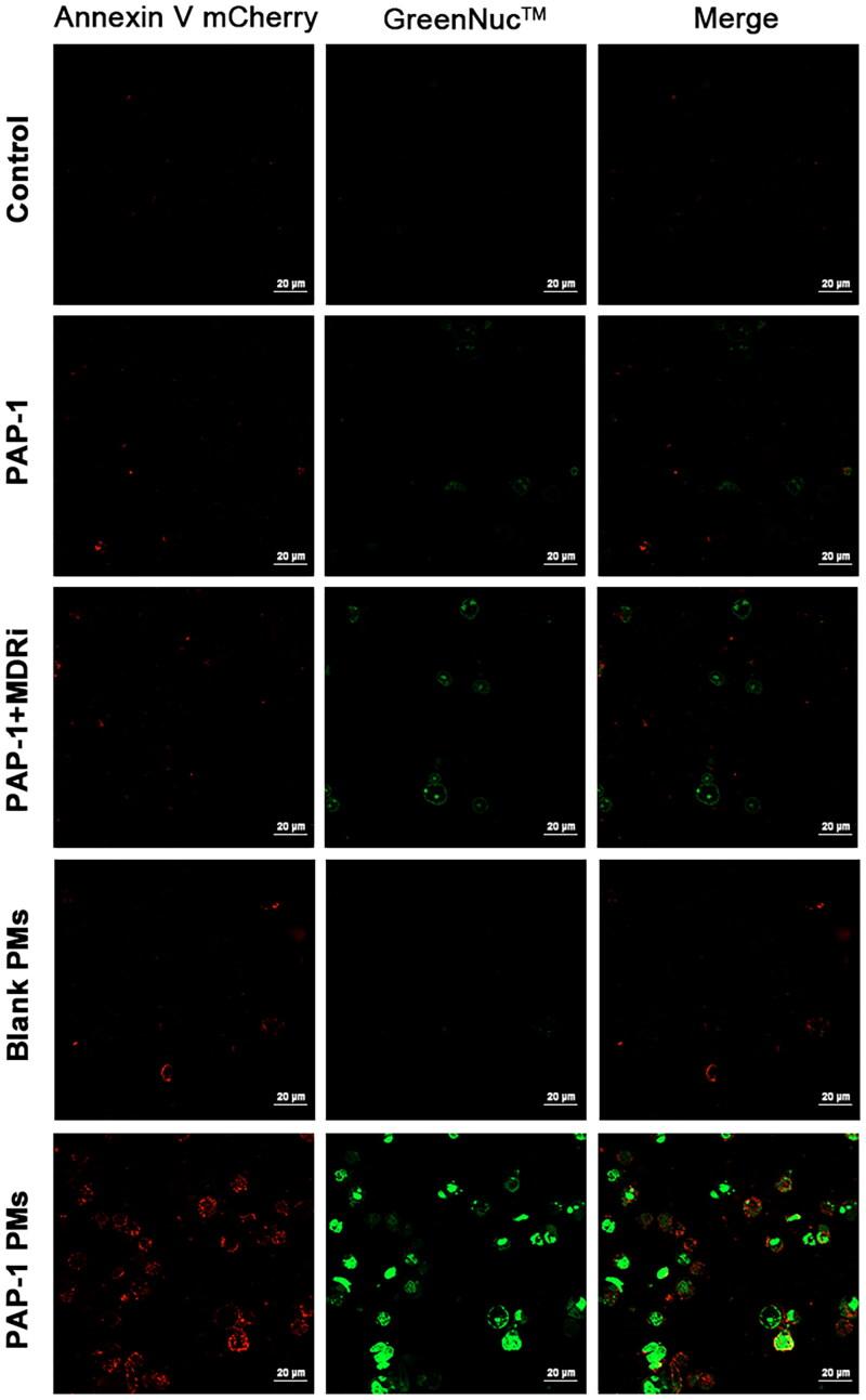 https://cdn.ncbi.nlm.nih.gov/pmc/blobs/827f/11986873/4dc150cb388b/IDRD_A_2490269_F0006_C.jpg