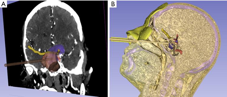 https://cdn.ncbi.nlm.nih.gov/pmc/blobs/8282/12322755/6571a3fdfbf8/gs-14-07-1318-f2.jpg