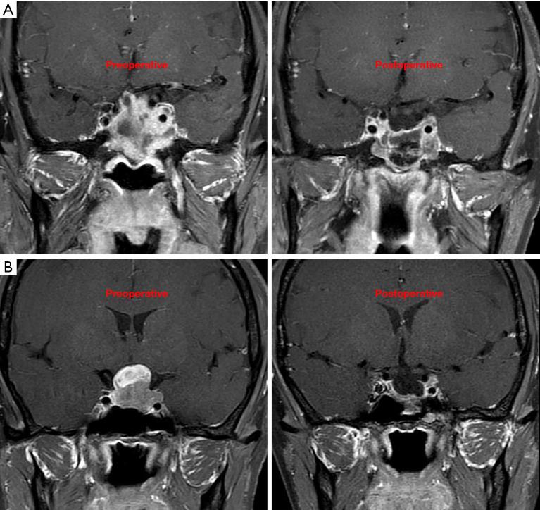 https://cdn.ncbi.nlm.nih.gov/pmc/blobs/8282/12322755/f3d339c16639/gs-14-07-1318-f10.jpg
