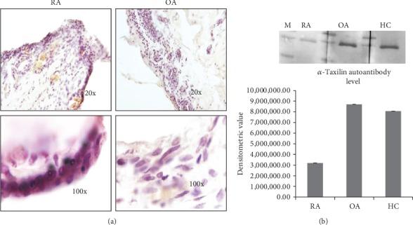 https://cdn.ncbi.nlm.nih.gov/pmc/blobs/8288/7195675/d0e9643a2100/JIR2020-4897983.005.jpg