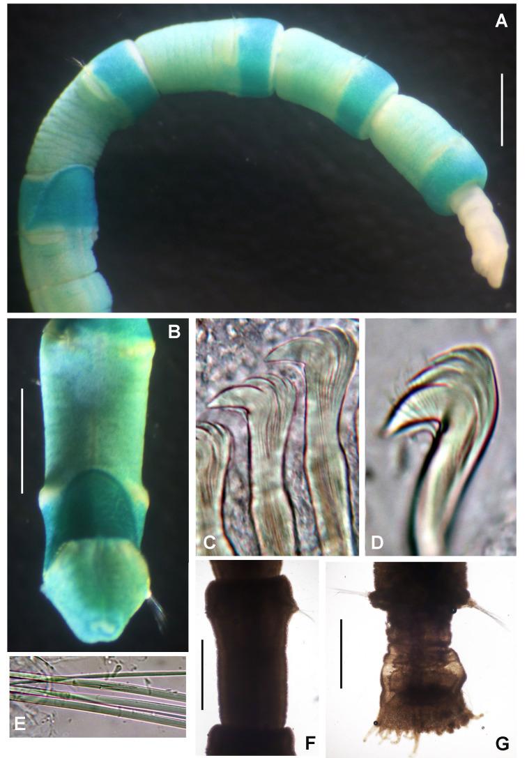 https://cdn.ncbi.nlm.nih.gov/pmc/blobs/8292/7511464/51a105050768/bdj-08-e57572-g003.jpg