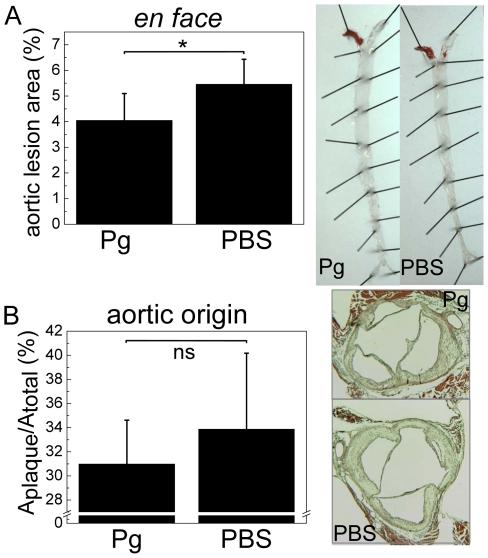 https://cdn.ncbi.nlm.nih.gov/pmc/blobs/8296/3320647/ebde2d275625/pone.0034910.g007.jpg