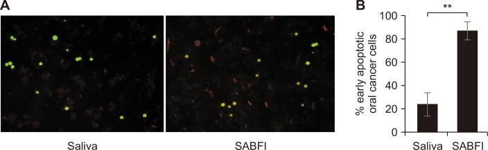 https://cdn.ncbi.nlm.nih.gov/pmc/blobs/8297/10564634/6d59135ea3c2/jcp-28-3-115-f6.jpg