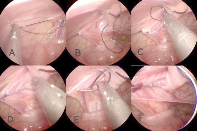 https://cdn.ncbi.nlm.nih.gov/pmc/blobs/8297/12290119/57e4f1b49b84/41598_2025_12539_Fig6_HTML.jpg