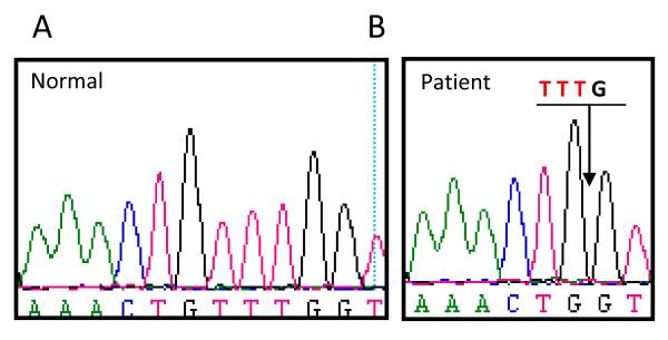 https://cdn.ncbi.nlm.nih.gov/pmc/blobs/8299/2903612/d843089b84a3/1710-1492-6-12-2.jpg