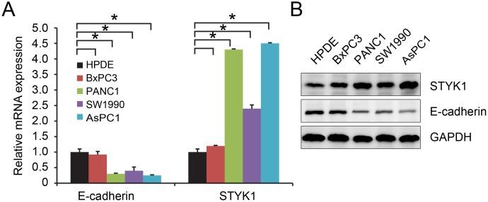 https://cdn.ncbi.nlm.nih.gov/pmc/blobs/829b/5762325/5d1d0cdd6595/oncotarget-08-111333-g005.jpg