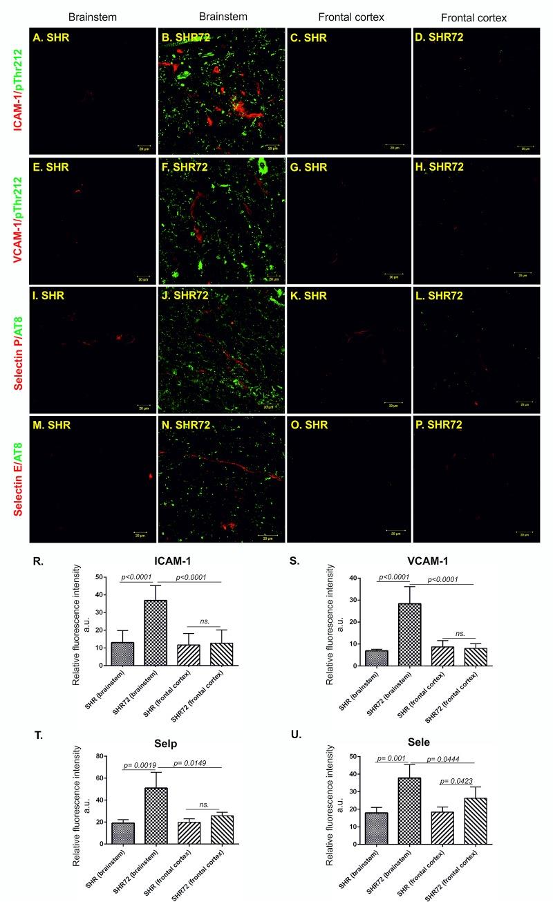 https://cdn.ncbi.nlm.nih.gov/pmc/blobs/829f/6532920/ac7ddc968cc2/pone.0217216.g006.jpg