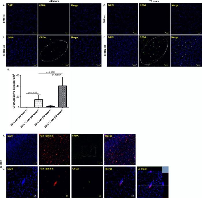https://cdn.ncbi.nlm.nih.gov/pmc/blobs/829f/6532920/f1aa29c54cdd/pone.0217216.g004.jpg