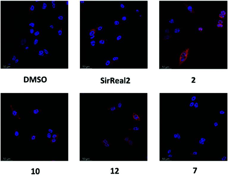 https://cdn.ncbi.nlm.nih.gov/pmc/blobs/829f/8985159/835309f6f88e/d1cb00244a-f7.jpg