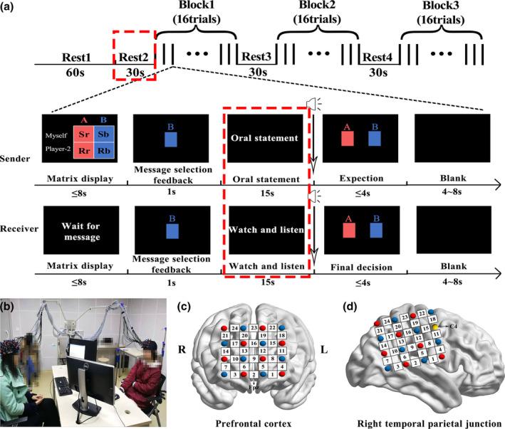 https://cdn.ncbi.nlm.nih.gov/pmc/blobs/82a3/7643389/9545b19508eb/HBM-41-4964-g001.jpg