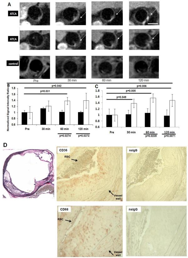 https://cdn.ncbi.nlm.nih.gov/pmc/blobs/82a5/3562260/bcd15c9f2985/1532-429X-15-7-1.jpg