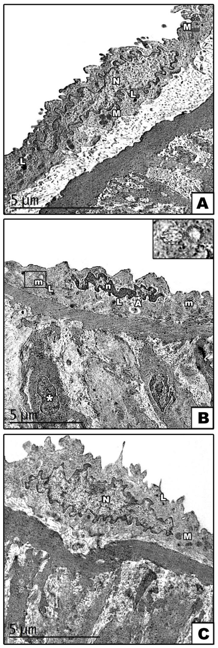 https://cdn.ncbi.nlm.nih.gov/pmc/blobs/82af/8750434/8ce51e73633c/cells-11-00048-g004.jpg