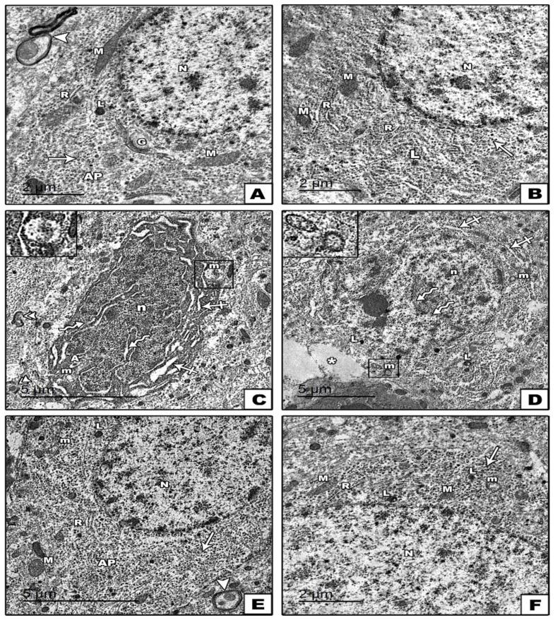https://cdn.ncbi.nlm.nih.gov/pmc/blobs/82af/8750434/b11b0b214165/cells-11-00048-g007.jpg