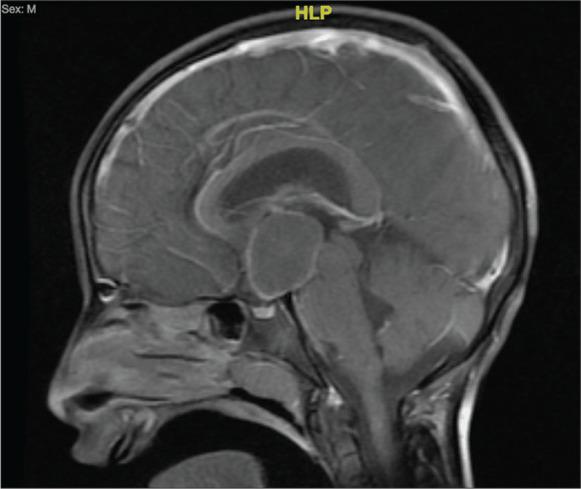 https://cdn.ncbi.nlm.nih.gov/pmc/blobs/82af/9899445/d2dc1abbbba3/SNI-13-602-g001.jpg