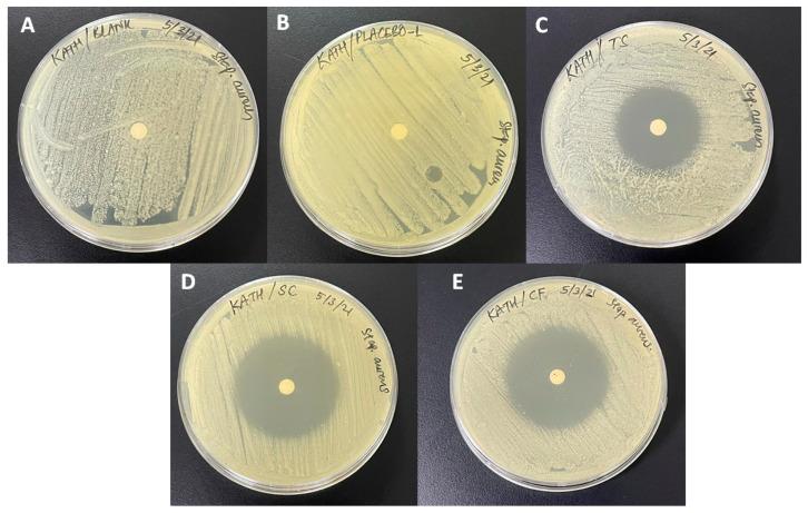 https://cdn.ncbi.nlm.nih.gov/pmc/blobs/82b5/8397977/49f83dd5a912/polymers-13-02770-g004.jpg
