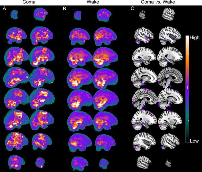 https://cdn.ncbi.nlm.nih.gov/pmc/blobs/82ba/12047610/60bb34ecad83/gr3.jpg