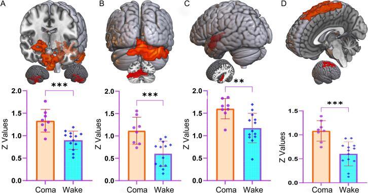 https://cdn.ncbi.nlm.nih.gov/pmc/blobs/82ba/12047610/736a79cffd9e/gr4.jpg