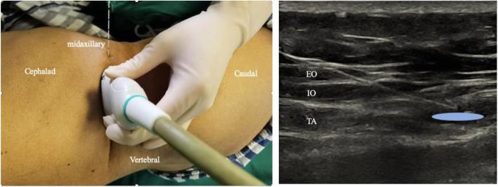 https://cdn.ncbi.nlm.nih.gov/pmc/blobs/82bf/8022542/d04d3f3f71a6/12871_2021_1317_Fig1_HTML.jpg