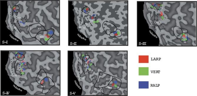 https://cdn.ncbi.nlm.nih.gov/pmc/blobs/82c0/3573326/25eb43225e93/fnbeh-07-00011-g0003.jpg