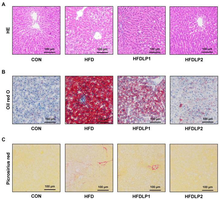 https://cdn.ncbi.nlm.nih.gov/pmc/blobs/82c1/10229879/162be2e29959/fmicb-14-1146672-g002.jpg