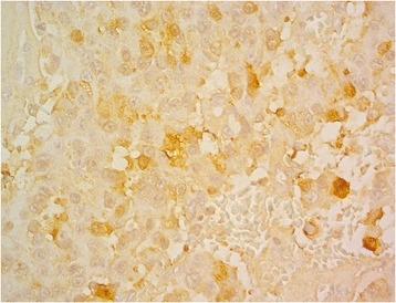 https://cdn.ncbi.nlm.nih.gov/pmc/blobs/82cc/4636740/740a75178ee6/12957_2015_728_Fig5_HTML.jpg