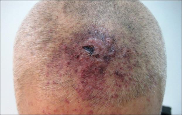 https://cdn.ncbi.nlm.nih.gov/pmc/blobs/82cf/5597656/5c7b9d97b3c4/ad-29-614-g001.jpg