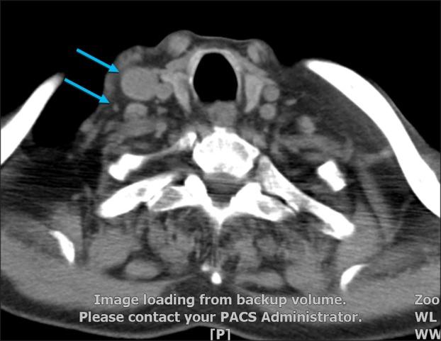 https://cdn.ncbi.nlm.nih.gov/pmc/blobs/82cf/5597656/5c834e3a03f3/ad-29-614-g004.jpg