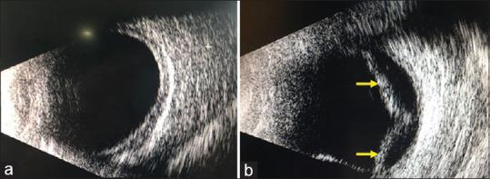 https://cdn.ncbi.nlm.nih.gov/pmc/blobs/82da/7508068/1f888d3f4f7d/IJO-68-1168-g003.jpg