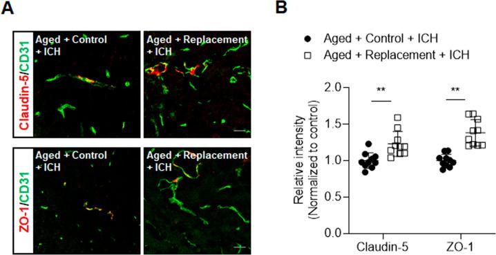 https://cdn.ncbi.nlm.nih.gov/pmc/blobs/82da/8748975/6d9ac49cbf4a/41419_2021_4424_Fig3_HTML.jpg