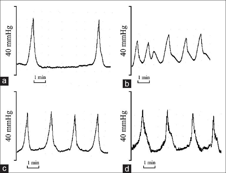 https://cdn.ncbi.nlm.nih.gov/pmc/blobs/82de/4834014/af0c6b0b78a4/CMJ-128-956-g001.jpg