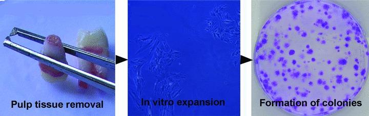 https://cdn.ncbi.nlm.nih.gov/pmc/blobs/82e2/3822618/d83d007d51b1/jcmm0015-1054-f2.jpg